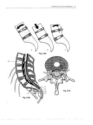 3. TRONCO E COLUNA VERTEBRAL   127




                Fig.3-80



CT




                                           Fig.3-81



     Fig.3-82
 