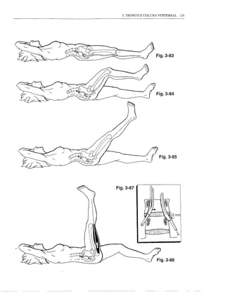 3. TRONCO E COLUNA VERTEBRAL   129




~~~   ~ ';:   -~   ~ ~_   [-         --::        Fig.3-83




                                                 Fig.3-84




                                                  Fig.3-85




                          Fig.3-87
 