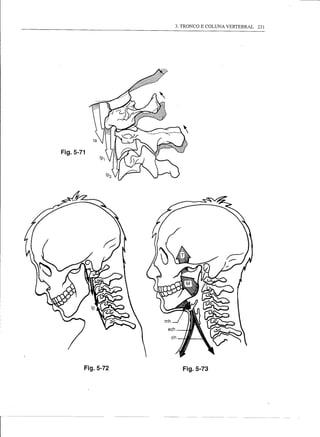3. TRONCO E COLUNA VERTEBRAL   231




Fig.5-71




           Fig.5-72     Fig.5-73
 