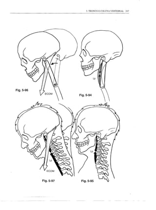 3. TRONCO E COLUNA VERTEBRAL   247




Fig.5-96
                      Fig.5-94




           Fig.5-97    Fig.5-95
 