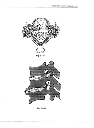 3. TRONCO E COLUNA VERTEBRAL   253




Fig.5-104




 Fig.5-105




 ---------
 
