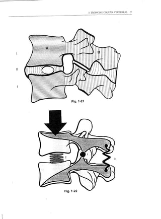 3. TRONCO E COLUNA VERTEBRAL                      27




                                                /            ~~1Il


                                                - --              1      ~

                                                                       ~                            ~~
                                                                        ~                            ~~~




I
                           .'                   ~~-    ---                    ~                             ~

     ~ .
     ~          I   (~r.:~
                       '-..
                      .
                                '.,
                                      [              ~'-.~ ~
                                                         ~    ""'"
                                                                                   /                    I
                                                                              I                         I
            ~
            y                              
                                                     ,~                   ~       ,....~
                                                                                               ,
                                                                                                   ,~


                                                                                                    1
                                                                                                        I


                                          -1              ~~ ••      !f                "



                ~
                     .-                         g
                                                                                           ~




                                          Fig.1-22
 