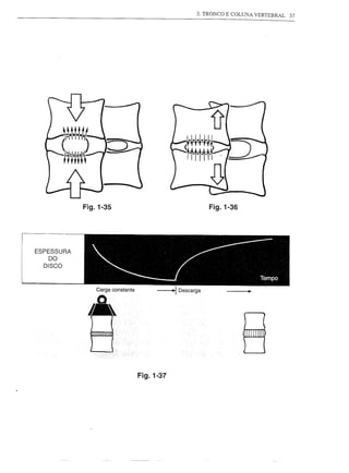 3. TRONCO E COLUNA VERTEBRAL   37




                 Fig.1-35                            Fig.1-36



i-U---
I   ESPESSURA
          DO
         DISCO



                    Carga constante




                                      Fig.1-37
 
