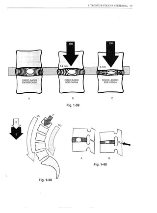 3. TRONCO E COLUNA VERTEBRAL   39




               DISCO SADIO                 DISCO LESADO
               SOB CARGA                     SOB CARGA




A                    B                              c

                Fig.1-39




                             A                  B


                                     Fig.1-40



    Fig.1-38
 