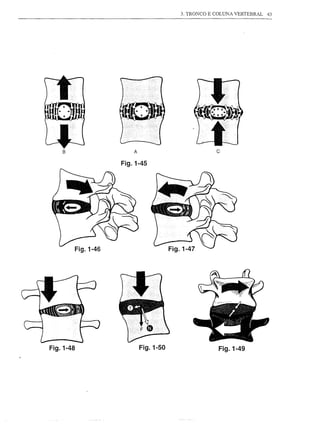 3. TRONCO E COLUNA VERTEBRAL   43




    B                     A                          c
                      Fig.1-45




           Fig.1-46




Fig.1-48                      Fig.1-50                Fig.1-49
 