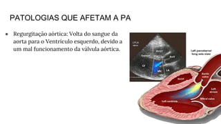 PATOLOGIAS QUE AFETAM A PA
● Regurgitação aórtica: Volta do sangue da
aorta para o Ventrículo esquerdo, devido a
um mal funcionamento da válvula aórtica.
 