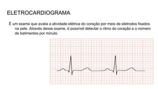 ELETROCARDIOGRAMA
É um exame que avalia a atividade elétrica do coração por meio de eletrodos fixados
na pele. Através desse exame, é possível detectar o ritmo do coração e o número
de batimentos por minuto.
 