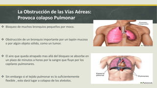 Insuficiencia Respiratoria | PPTX