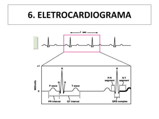 6. ELETROCARDIOGRAMA
 