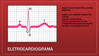 ELETROCARDIOGRAMA
Onda T- A sua inversão indica processo
isquêmico
Onda P- Sua amplitude máxima é de
0,25 Mv;
Tamanho normal: Altura:
2,5 mm, comprimento: 3,0 mm;
A Hipertrofia atrial causa um aumento
na altura e/ou duração da Onda P.
 