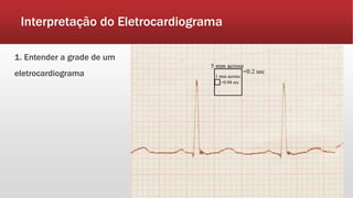 Interpretação do Eletrocardiograma
1. Entender a grade de um
eletrocardiograma
 