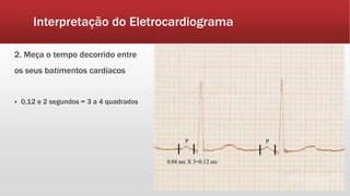 Interpretação do Eletrocardiograma
2. Meça o tempo decorrido entre
os seus batimentos cardíacos
 0,12 e 2 segundos = 3 a 4 quadrados
 