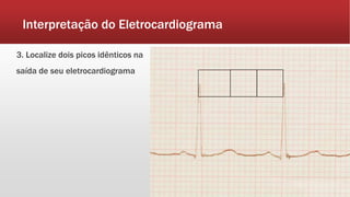 Interpretação do Eletrocardiograma
3. Localize dois picos idênticos na
saída de seu eletrocardiograma
 