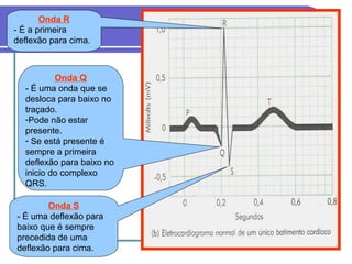 Onda R
- É a primeira
deflexão para cima.
Onda Q
- É uma onda que se
desloca para baixo no
traçado.
-Pode não estar
presente.
- Se está presente é
sempre a primeira
deflexão para baixo no
inicio do complexo
QRS.
Onda S
- É uma deflexão para
baixo que é sempre
precedida de uma
deflexão para cima.
 