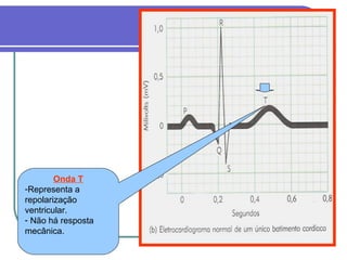 Onda T
-Representa a
repolarização
ventricular.
- Não há resposta
mecânica.
 