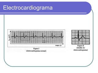 Electrocardiograma
 