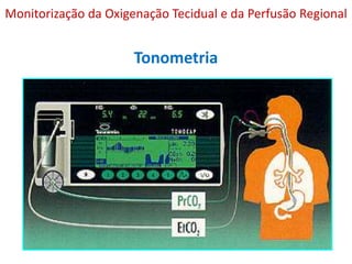 Tonometria
Monitorização da Oxigenação Tecidual e da Perfusão Regional
 