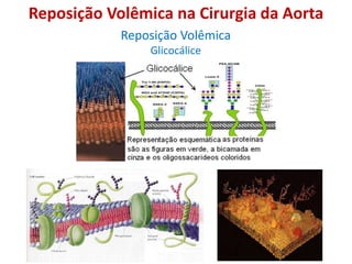 Reposição Volêmica na Cirurgia da Aorta
Reposição Volêmica
Glicocálice
 