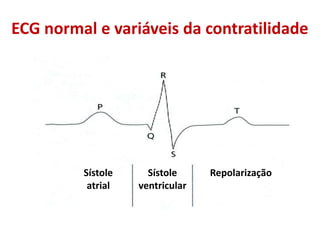 ECG normal e variáveis da contratilidade
Sístole
atrial
Sístole
ventricular
Repolarização
 