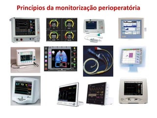 Princípios da monitorização perioperatória
 
