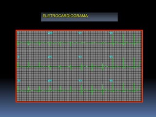 ELETROCARDIOGRAMA
 
