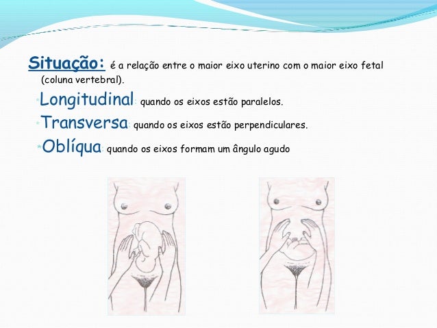 Feto em situacao longitudinal apresentacao cefalica com dorso a direita