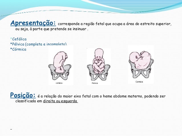 Feto em situacao longitudinal apresentacao cefalica com dorso a direita