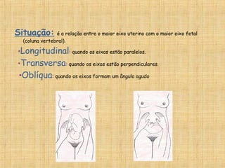 Situação: é a relação entre o maior eixo uterino com o maior eixo fetal
(coluna vertebral).
   *Longitudinal: quando os eixos estão paralelos.
   *Transversa: quando os eixos estão perpendiculares.
*Oblíqua: quando os eixos formam um ângulo agudo
 