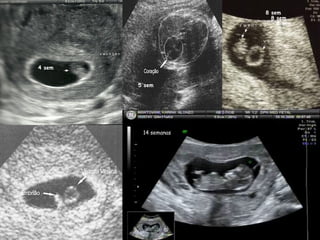 4 sem
5 sem
8 sem
8 sem
8 sem
14 semanas
 