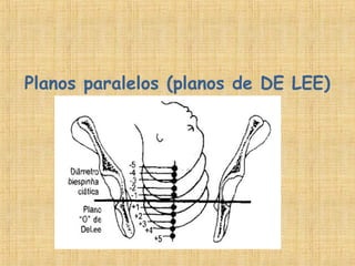 Planos paralelos (planos de DE LEE)
 