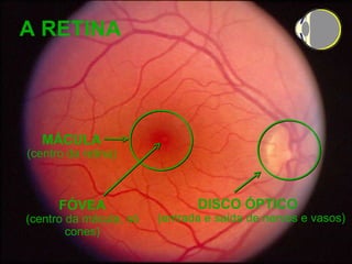A RETINA FÓVEA (centro da mácula, só cones) DISCO ÓPTICO   (entrada e saída de nervos e vasos) MÁCULA (centro da retina) 