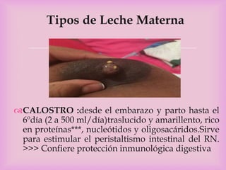 Fisiologia de la lactancia materna | PPTX