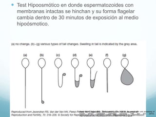 Fisiologia Del Aparato Reproductor Masculino PPTX fisiologia-del-aparato-reproductor-masculino-pptx