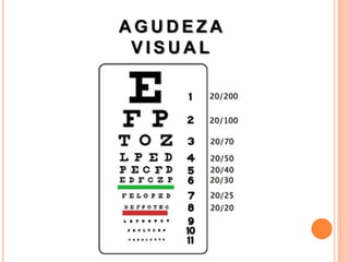 AGUDEZA
 VISUAL
 