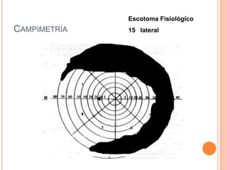 Escotoma Fisiológico
CAMPIMETRÌA   15 lateral
 