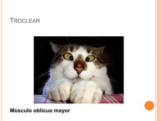 TROCLEAR




Mùsculo oblicuo mayor
 