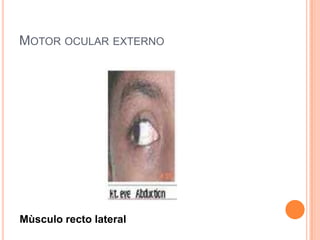 MOTOR OCULAR EXTERNO




Mùsculo recto lateral
 