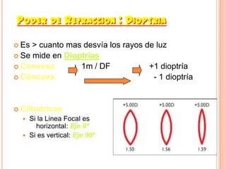 PODER DE REFRACCION : DIOPTRIA

 Es > cuanto mas desvía los rayos de luz
 Se mide en Dioptrías
 Convexa        1m / DF            +1 dioptría
 Cóncava                            - 1 dioptría


 Cilindricas
   Si la Linea Focal es
      horizontal: Eje 0º
   Si es vertical: Eje 90º
 