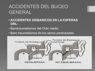 ACCIDENTES DEL BUCEO
GENERAL
ACCIDENTES DISBARICOS EN LA ESFERAS
ORL:
• Barotraumatismos del Oído medio
• Baro traumatismos de los senos paranasales
 