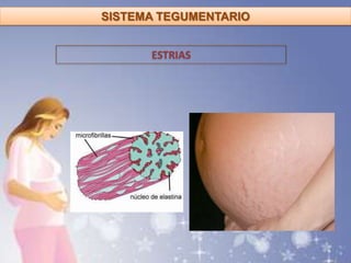 ESTRIAS
SISTEMA TEGUMENTARIO
 