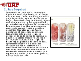 2. Los loquios
Se denomina "loquios" al contenido
líquido normal expulsado por el útero
en su proceso de involución y curación
de la superficie cr uenta dejada por el
lecho placentar io. Los loquios no tienen
mal olor y son var iables en cantidad y
características a lo largo del puer per io.
Los pr imeros tres días contienen una
mezcla de sangre fresca y decidua
necrótica (loquios rojos), luego
disminuye el contenido sanguíneo
tor nándose más pálido (loquios
serosos). Ya en la segunda semana el
líquido se aclara transformándose a
color blanco amar illento (loquios
blancos). La pérdida de loquios dura
aproximadamente 4 a 6 semanas
coincidente con el término de la
involución uter ina, aunque persiste un
infiltrado leucocitar io crónico en el
miometr io alrededor de 4 meses, que
equivocadamente puede hacer pensar
en una endometr itis.

 