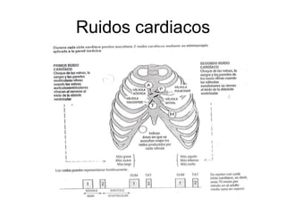 Ruidos cardiacos
 