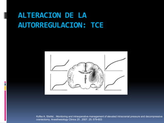 ALTERACION DE LA AUTORREGULACION: TCEKofke A, Stiefel, . Monitoring and intraoperative management of elevated intracranial pressure and decompressive craniectomy. Anesthesiology Clinics 25 . 2007. 25: 579-603 