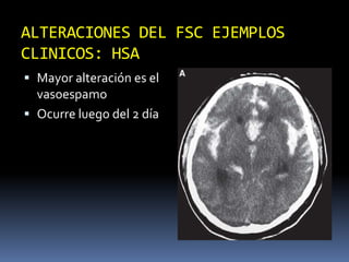 ALTERACIONES DEL FSC EJEMPLOS CLINICOS: HSAMayor alteración es el vasoespamoOcurre luego del 2 día
