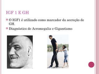 IGF 1 E GH
 O IGF1 é utilizado como marcador da secreção de
  GH.
 Diagnóstico de Acromegalia e Gigantismo
 