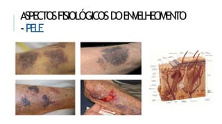 ASPECTOSFISIOLÓGICOSDOENVELHECIMENTO
-PELE
 