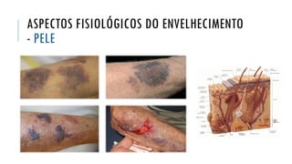 ASPECTOS FISIOLÓGICOS DO ENVELHECIMENTO
- PELE
 
