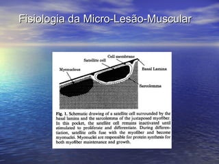 Fisiologia da Micro-Lesão-Muscular 