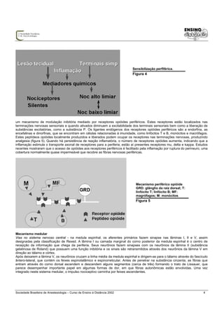 Sensibilização perfiférica.
                                                                              Figura 4




um mecanismo de modulação inibitória mediado por receptores opióides periféricos. Estes receptores estão localizados nas
terminações nervosas sensoriais e quando ativados diminuem a excitabilidade dos terminais sensoriais bem como a liberação de
substâncias excitatórias, como a substância P. Os ligantes endógenos dos receptores opióides periféricos são a endorfina, as
encefalinas e dinorfinas, que se encontram em células relacionadas à imunidade, como linfócitos T e B, monócitos e macrófagos.
Estes peptídeos opióides localmente produzidos e liberados podem ocupar os receptores nas terminações nervosas, produzindo
analgesia (figura 5). Quando há persistência de reação inflamatória, o número de receptores opióides aumenta, indicando que a
inflamação estimula o transporte axonal de receptores para a periferia; estão aí presentes receptores mu, delta e kappa. Estudos
recentes mostraram que o acesso de opióides aos receptores periféricos é facilitado pela inflamação por ruptura do perineuro, uma
cobertura normalmente quase impermeável que recobre as fibras nervosas periféricas.




                                                                                Mecanismo periférico opióide
                                                                                GRD: glânglio da raiz dorsal; T:
                                                                                linfócito T; linfócito B; MF:
                                                                                magrófagos; M: monócitos
                                                                                Figura 5




Mecanismo medular
Vias no sistema nervoso central - na medula espinhal, os aferentes primários fazem sinapse nas lâminas I, II e V, assim
designadas pela classificação de Rexed. A lâmina I ou camada marginal do corno posterior da medula espinhal é o centro de
recepção da informação que chega da periferia. Seus neurônios fazem sinapses com os neurônios da lâmina II (substância
gelatinosa de Roland) que possuem uma função inibitória e os sinais são retransmitidos através dos neurônios da lâmina V em
direção ao tálamo e córtex.
Após deixarem a lâmina V, os neurônios cruzam a linha média da medula espinhal e dirigem-se para o tálamo através do fascículo
ântero-lateral, que contém os feixes espinotalâmico e espinorreticular. Antes de penetrar na substância cinzenta, as fibras que
entram através do corno dorsal ascendem e descendem alguns segmentos (cerca de três) formando o trato de Lissauer, que
parece desempenhar importante papel em algumas formas de dor, em que fibras autonômicas estão envolvidas. Uma vez
integrado neste sistema medular, o impulso nociceptivo caminha por feixes ascendentes.




Sociedade Brasileira de Anestesiologia – Curso de Ensino à Distância 2002                                                     4
 