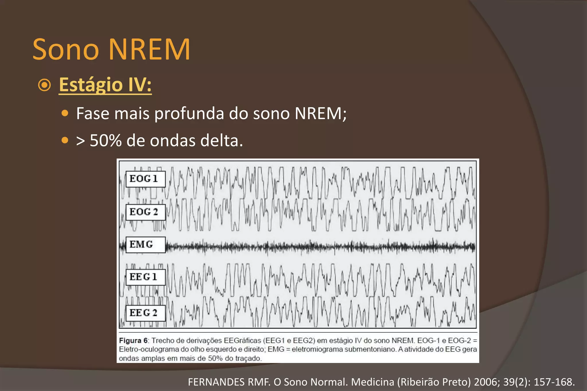 Sono NREM
 Estágio IV:
 Fase mais profunda do sono NREM;
 > 50% de ondas delta.
FERNANDES RMF. O Sono Normal. Medicina (Ribeirão Preto) 2006; 39(2): 157-168.
 